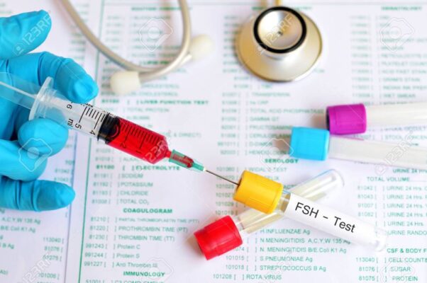 Xét nghiệm nội tiết tố nữ