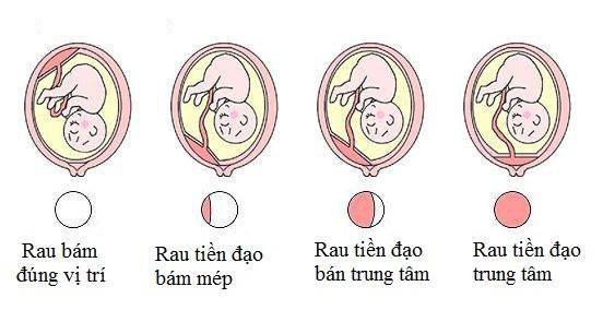 rau tiền đạo